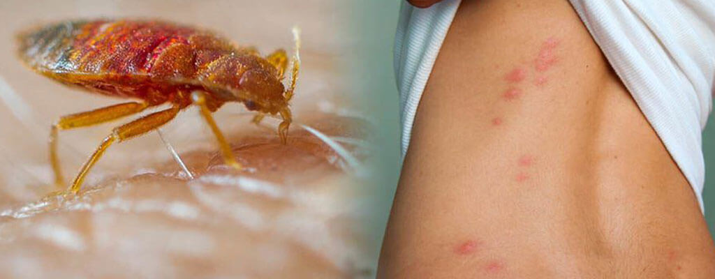 Bed bug control service in Kolkata