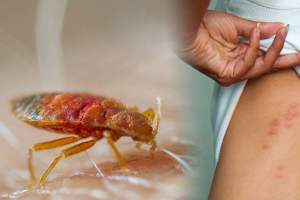 Bed Bug pest control near me in Kolkata